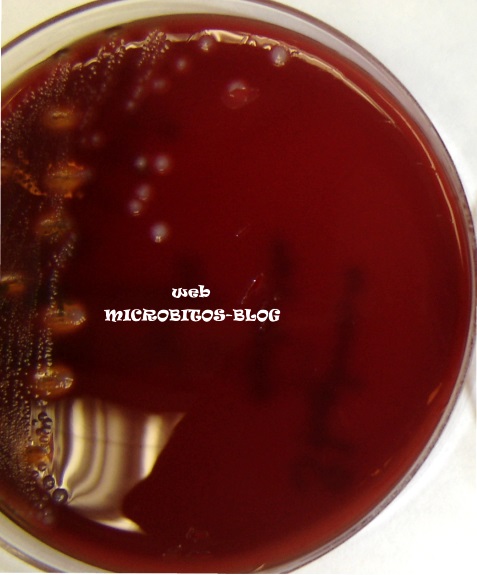 streptococcus-betahemolisis