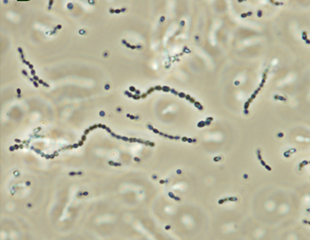 Streptococcus_ssp con formacion de cadena de cocos largas y cortas